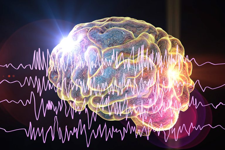 epilepsia